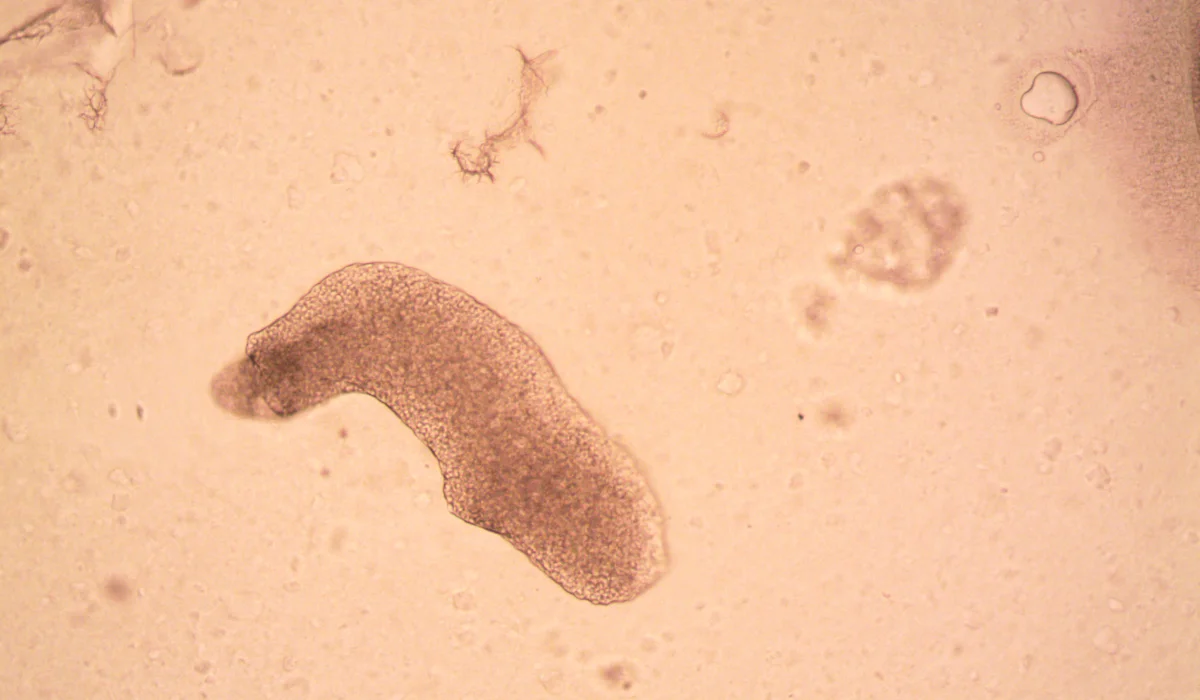 Ekusupedexia